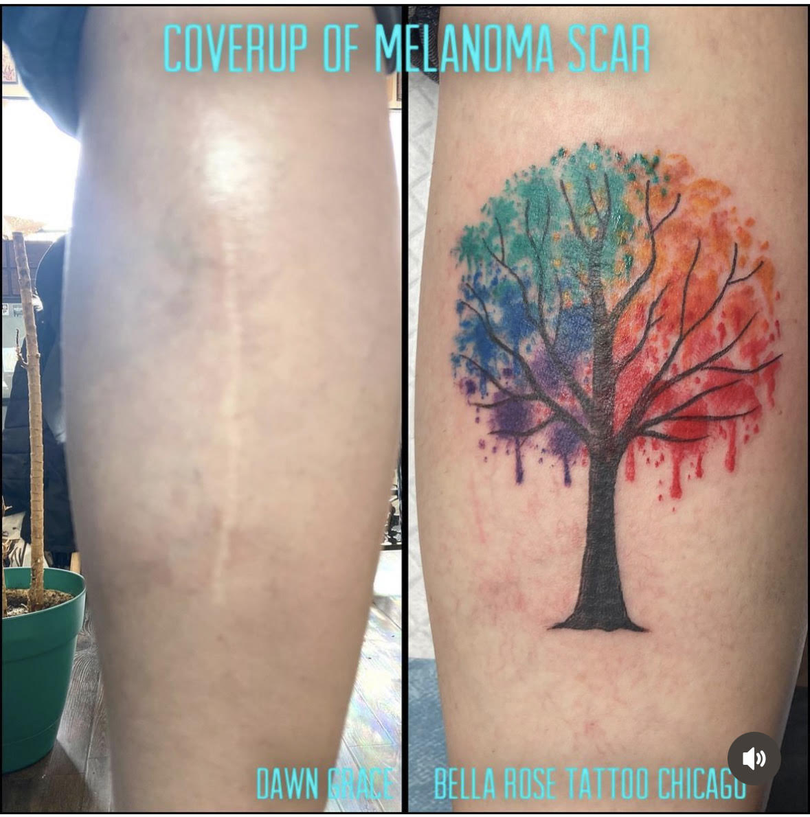 cover up tattoo chicagoTikTok Search